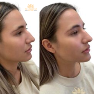 cosmetic clinic- jawline contour image 5