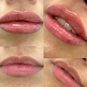 cosmetic clinic -lipsr image 1