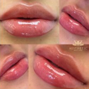 cosmetic clinic -lipsr image 3