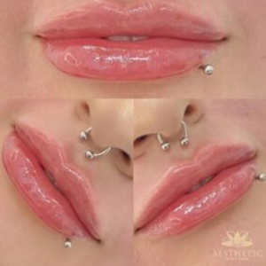 cosmetic clinic -lipsr image 6